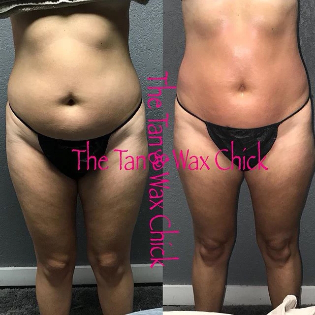Ice Me Body Contouring