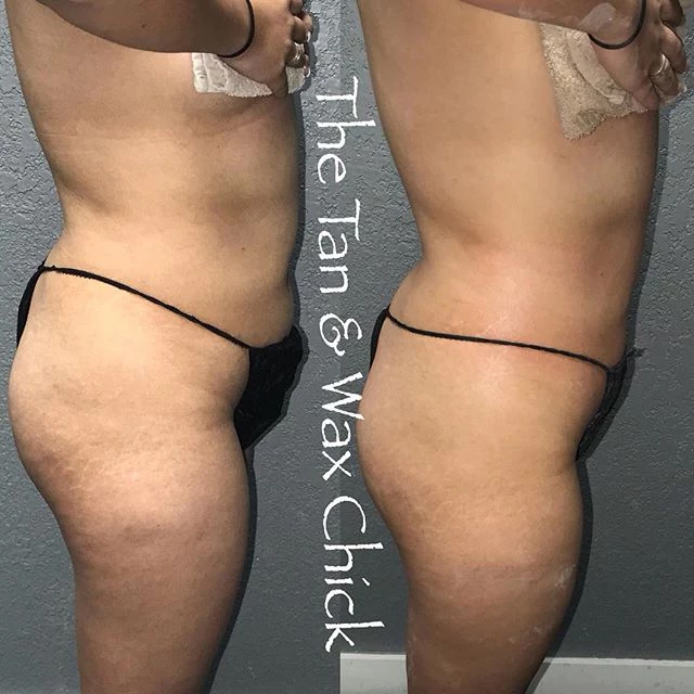 Ice Me Body Contouring