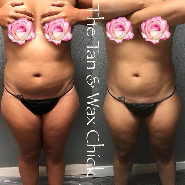 Ice Me Body Contouring