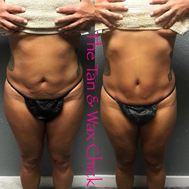 Ice Me Body Contouring