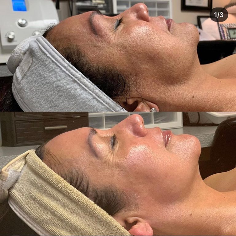 skin-care-before-and-after-01