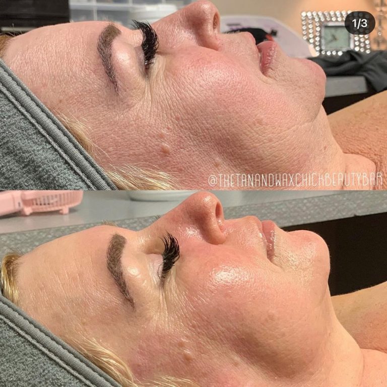 skin-care-before-and-after-02