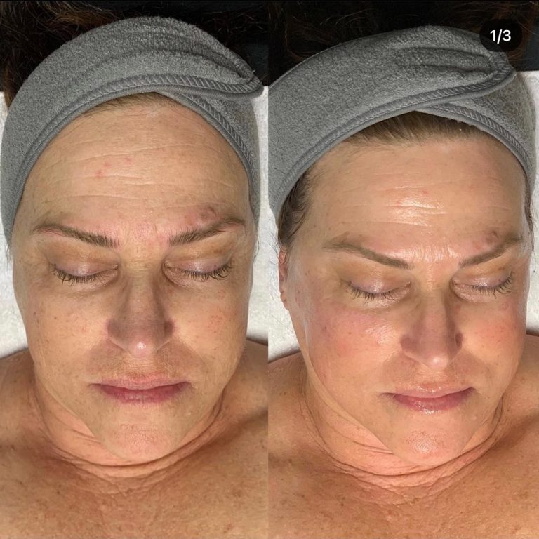 skin-care-before-and-after-03