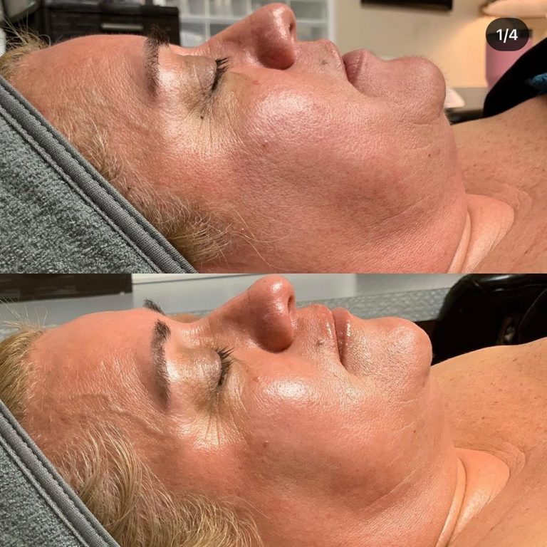 skin-care-before-and-after-06
