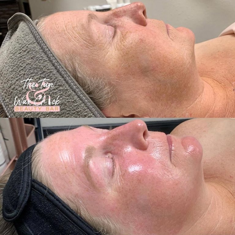 skin-care-before-and-after-07