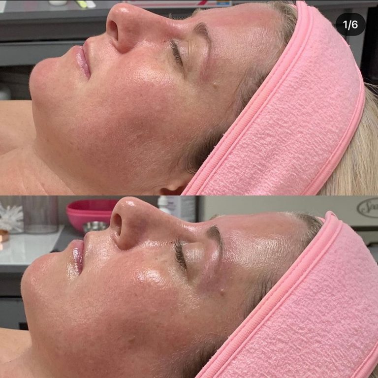 skin-care-before-and-after-09