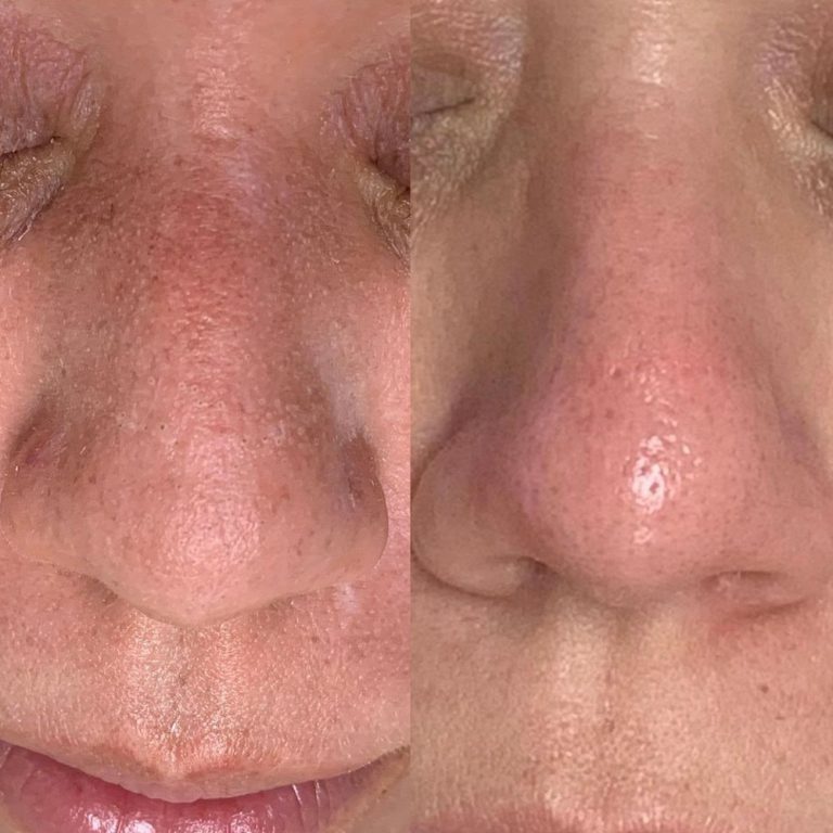 skin-care-before-and-after-10