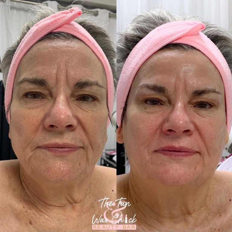 skin-care-before-and-after-13