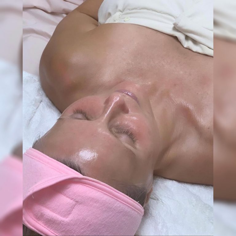 skin-care-before-and-after-16