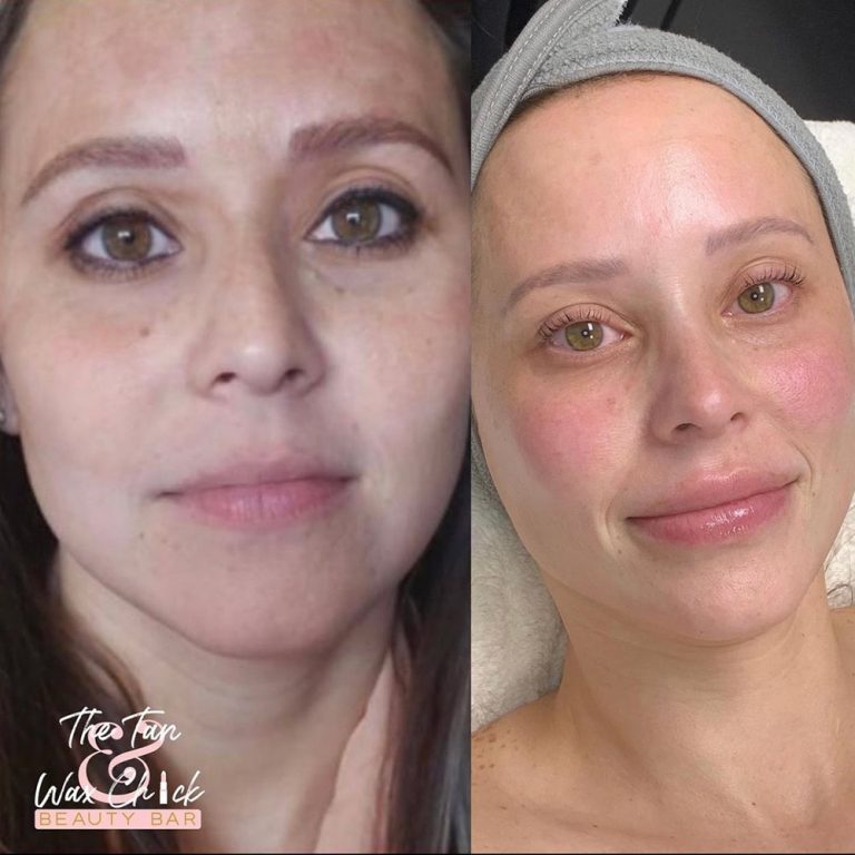 skin-care-before-and-after-17